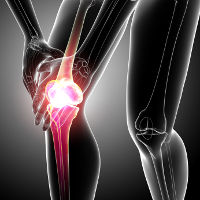 Knee pain