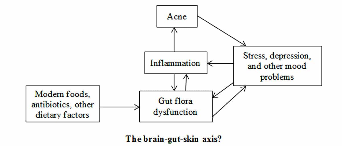 paleo and acne