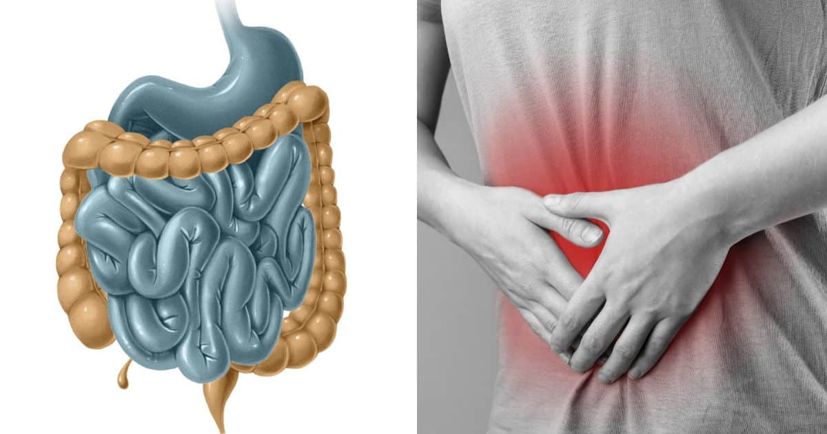 What is a Gut Irritant, Anyway? A Beginner's Guide