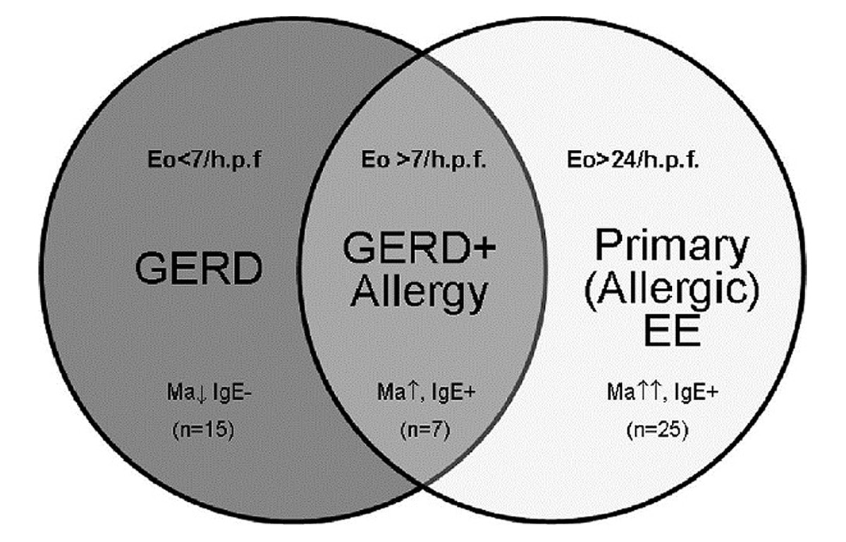 gerd vs ee