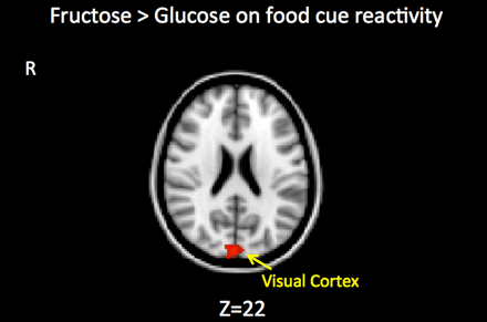 Fructose vs. glucose