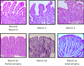 Marsh classification system