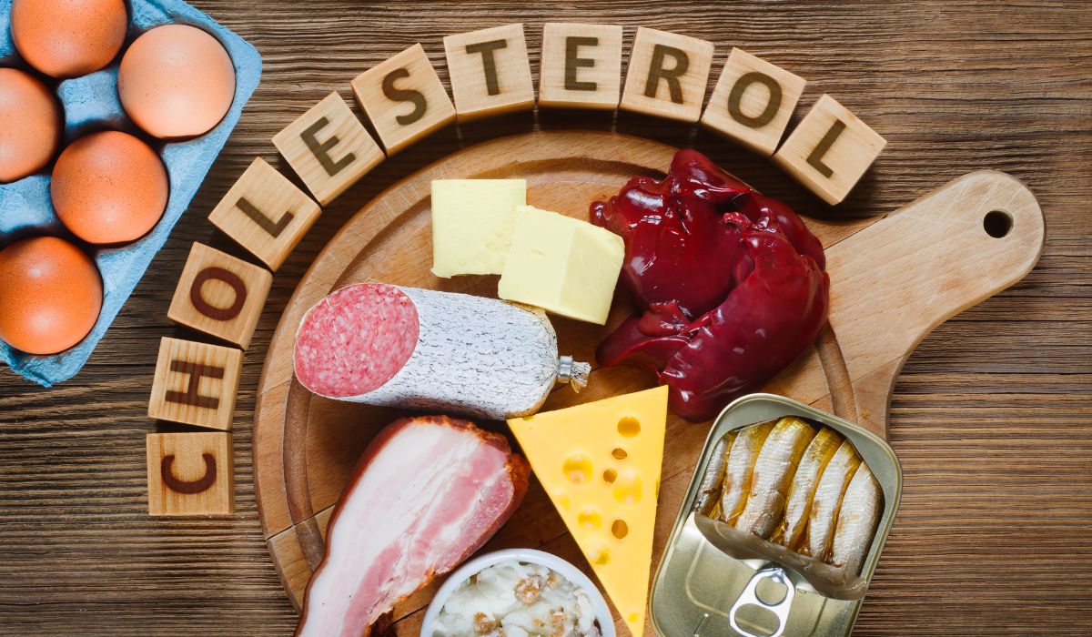 Cholesterol