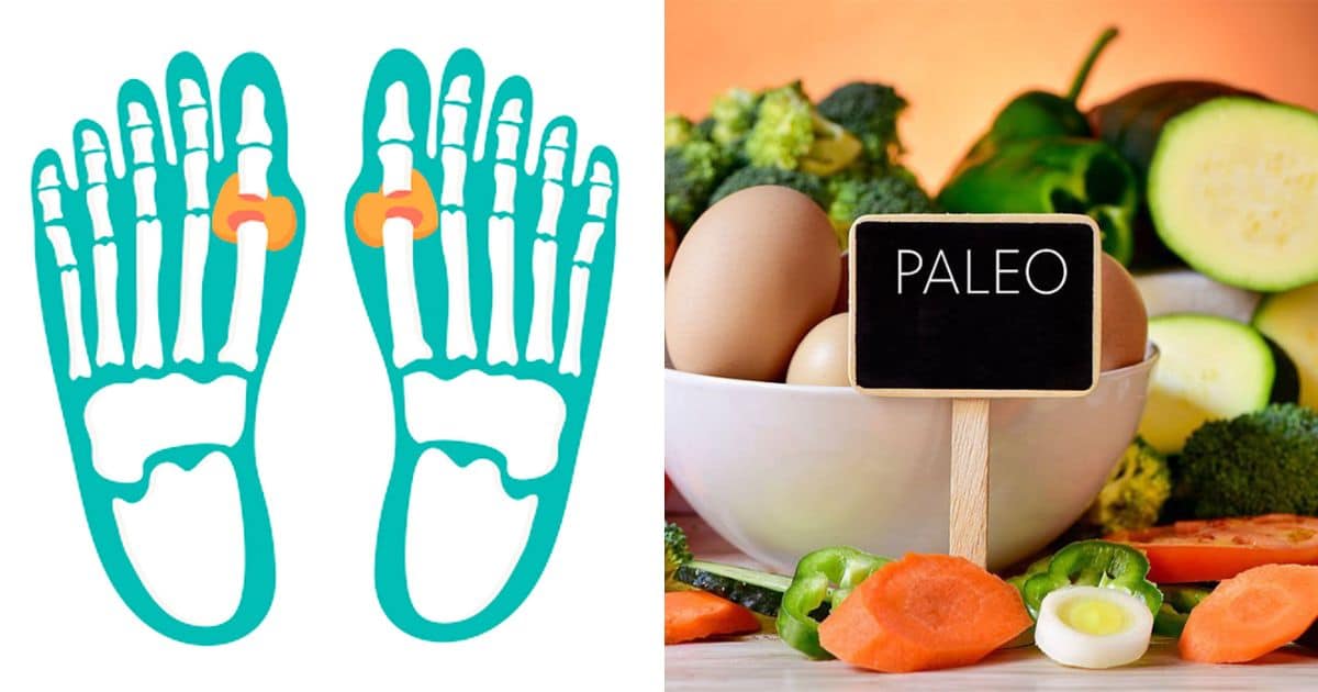 Paleo and Rheumatoid Arthritis Paleo Leap